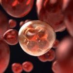 Prostate Cancer is very common with aging men.