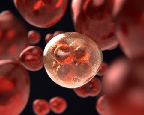 Prostate Cancer is very common with aging men.