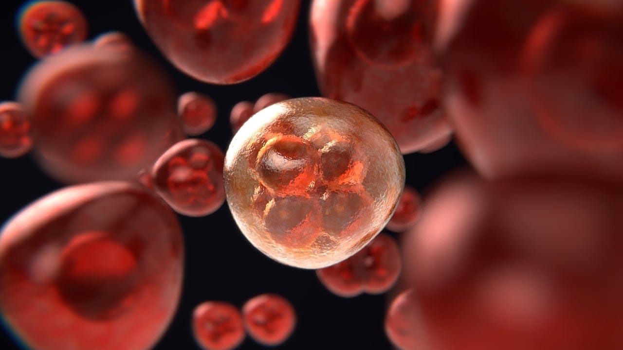 Prostate Cancer is very common with aging men.